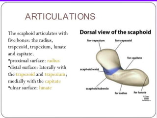 Scaphoid fracture (2)
