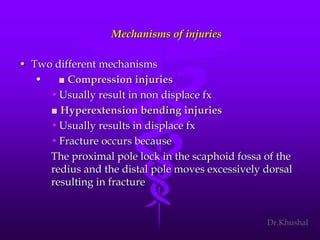Scaphoid fracture (2)