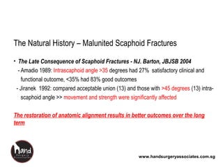 www.handsurgeryassociates.com.sg
The Natural History – Malunited Scaphoid Fractures
• The Late Consequence of Scaphoid Fractures - NJ. Barton, JBJSB 2004
- Amadio 1989: Intrascaphoid angle >35 degrees had 27% satisfactory clinical and
functional outcome, <35% had 83% good outcomes
- Jiranek 1992: compared acceptable union (13) and those with >45 degrees (13) intra-
scaphoid angle >> movement and strength were significantly affected
The restoration of anatomic alignment results in better outcomes over the long
term
 