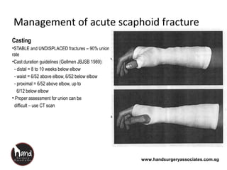 www.handsurgeryassociates.com.sg
Management of acute scaphoid fracture
Casting
•STABLE and UNDISPLACED fractures – 90% union
rate
•Cast duration guidelines (Gellmen JBJSB 1989):
- distal = 8 to 10 weeks below elbow
- waist = 6/52 above elbow, 6/52 below elbow
- proximal = 6/52 above elbow, up to
6/12 below elbow
• Proper assessment for union can be
difficult – use CT scan
 