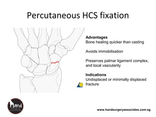 www.handsurgeryassociates.com.sg
Percutaneous HCS fixation
Advantages
Bone healing quicker than casting
Avoids immobilisation
Preserves palmar ligament complex,
and local vascularity
Indications
Undisplaced or minimally displaced
fracture
 