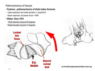 www.handsurgeryassociates.com.sg
Pathomechanics of fracture
• Frykman ; pathomechanics of distal radius fractures
- hyper-extension and radial deviation = scaphoid #
- lesser extension and lesser force = DR#
• Weber, Chao 1978
- Wrist extension beyond 95 degrees
- Radial deviation beyond 10 degrees
LockedLocked
IntoInto
fossafossa
BeyondBeyond
normalnormal
limitlimit
# in# in
tensiontension
 