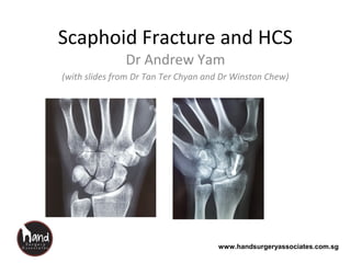 www.handsurgeryassociates.com.sg
Scaphoid Fracture and HCS
Dr Andrew Yam
(with slides from Dr Tan Ter Chyan and Dr Winston Chew)
 