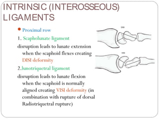 INTRINSIC (INTEROSSEOUS)
LIGAMENTS
Proximal row
1. Scapholunate ligament
disruption leads to lunate extension
when the scaphoid flexes creating
DISI deformity
2.lunotriquetral ligament
disruption leads to lunate flexion
when the scaphoid is normally
aligned creating VISI deformity (in
combination with rupture of dorsal
Radiotriquetral rupture)
 