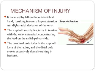 MECHANISM OF INJURY
It is caused by fall on the outstretched
hand, resulting in severe hyperextension
and slight radial deviation of the wrist
The scaphoid usually fractures in tension
with the wrist extended, concentrating
the load on the radial-palmar side.
The proximal pole locks in the scaphoid
fossa of the radius, and the distal pole
moves excessively dorsal resulting in
fracture.
 