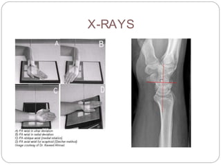 X-RAYS
 