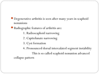 Degenerative arthritis is seen after many years in scaphoid
nonunions
Radiographic features of arthritis are:
1. Radioscaphoid narrowing
2. Capitolunate narrowing
3. Cyst formation
4. Pronounced dorsal intercalated segment instability
This is so called scaphoid nonunion advanced
collapse pattern
 