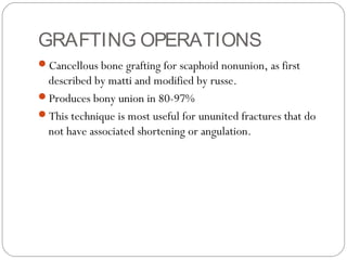 GRAFTING OPERATIONS
Cancellous bone grafting for scaphoid nonunion, as first
described by matti and modified by russe.
Produces bony union in 80-97%
This technique is most useful for ununited fractures that do
not have associated shortening or angulation.
 