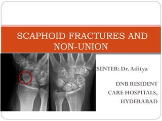 PRESENTER: Dr.Aditya
DNB RESIDENT
CARE HOSPITALS,
HYDERABAD
SCAPHOID FRACTURES AND
NON-UNION
 