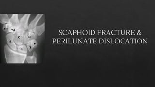 SCAPHOID FRACTURE &
PERILUNATE DISLOCATION
 