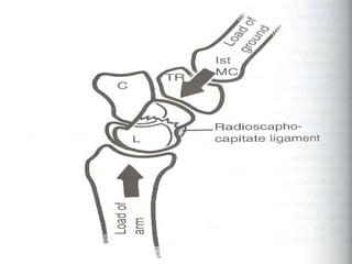 Scaphoid Multangular Joint Comprehensive Overview of Scaphoid Fractures: Anatomy, Diagnosis, and ...