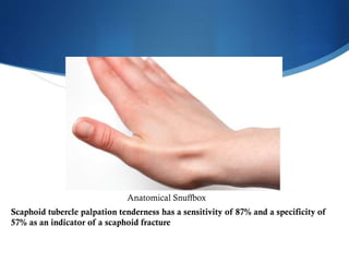 Anatomical Snuffbox
Scaphoid tubercle palpation tenderness has a sensitivity of 87% and a specificity of
57% as an indicator of a scaphoid fracture

 