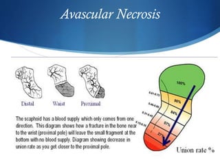 Avascular Necrosis

 
