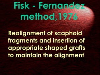 Scaphoid fractures | PPT