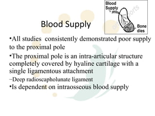 Blood Supply
•All studies consistently demonstrated poor supply
to the proximal pole
•The proximal pole is an intra-articular structure
completely covered by hyaline cartilage with a
single ligamentous attachment
–Deep radioscapholunate ligament
•Is dependent on intraosseous blood supply
 