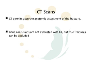 CT Scans
 CT permits accurate anatomic assessment of the fracture.



 Bone contusions are not evaluated with CT, but true fractures
  can be excluded
 