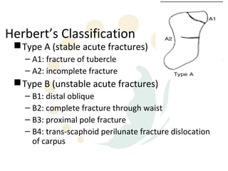 Herbert’s Classification
  Type A (stable acute fractures)
   – A1: fracture of tubercle
   – A2: incomplete fracture
  Type B (unstable acute fractures)
   – B1: distal oblique
   – B2: complete fracture through waist
   – B3: proximal pole fracture
   – B4: trans-scaphoid perilunate fracture dislocation
     of carpus
 
