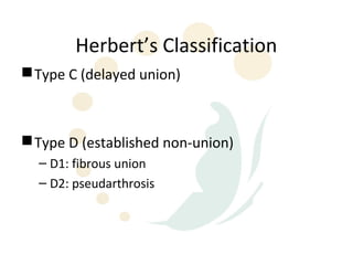 Herbert’s Classification
 Type C (delayed union)



 Type D (established non-union)
  – D1: fibrous union
  – D2: pseudarthrosis
 