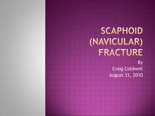 Scaphoid (navicular) fracture By Craig Coldwell August 31, 2010 
