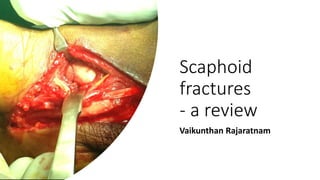 Scaphoid
fractures
- a review
Vaikunthan Rajaratnam
 