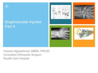 +
Scapholunate Injuries
Part II
Hussain Algawahmed, MBBS, FRCSC
Consultant Orthopedic Surgeon
Riyadh Care Hospital
 