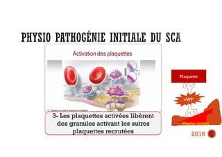 1 -Exposition du matériel hautement
thrombogéne de la plaque avec le flux
sanguin suite a la rupture
2- Liaison de la plaquette avec le collagène sous-
endothèlial + liaison des glycoprotéines de la plaque
avec le facteur de von willbrand entrainant le
recrutement des plaquettes
3- Les plaquettes activées libèrent
des granules activant les autres
plaquettes recrutées
vWF
Plaquette
Plaque rompu
2016
 