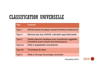 Circulation 2012 2016
 