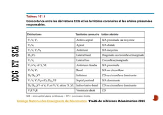 Collège National des Enseignants de Réanimation Traité de référence Réanimation 2016
 