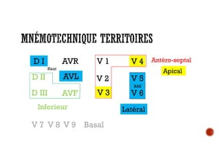 D II
AVR
D III AVF
AVL
V 1
V 2 V 5
V 3
V 4
V 6
Inferieur
Antéro-septalV 4
V 3
Apical
V 5
V 6
D I
Latéral
AVL
BAS
Haut
V 9V 8V 7 Basal
 
