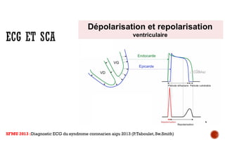 SFMU 2013 :Diagnostic ECG du syndrome coronarien aigu 2013 (P.Taboulet,Sw.Smith)
 