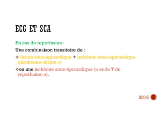 En cas de reperfusion :
Une combinaison transitoire de :
 lésion sous-épicardique + ischémie sous-épicardique
(«ischémie–lésion »)
ou une ischémie sous-épicardique (« onde T de
reperfusion »).
2016
 