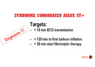 SYNDROME CORONARIEN AIGUE ST+
2016
 