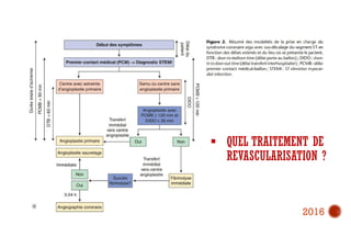  QUEL TRAITEMENT DE
REVASCULARISATION ?
2016
 
