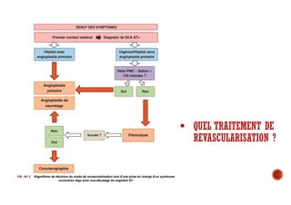  QUEL TRAITEMENT DE
REVASCULARISATION ?
 