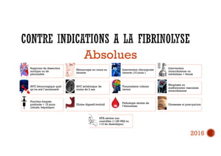 Suspicion de dissection
aortique ou de
péricardite
Hémorragie en cours ou
récente
Intervention chirurgicale
récente (10 jours )
Intervention
intracrânienne ou
médullaire < 6mois
AVC hémorragique quel
qu’en soit l’ancienneté
AVC ischémique de
moins de 2 ans
Traumatisme crânien
récent
Néoplasie ou
malformation vasculaire
intracrânienne
Ponction-biopsie
profonde < 15 jours
(rénale, hépatique)
Ulcère digestif évolutif
Pathologie sévère de
l’hémostase
Grossesse et post-partum
HTA sévère non
contrôlée (>180 PAS ou
110 de diastolique)
Absolues
2016
 