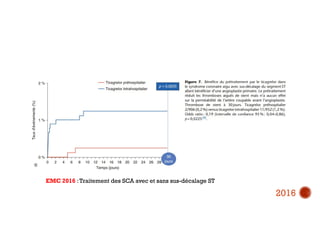 2016
EMC 2016 :Traitement des SCA avec et sans sus-décalage ST
 