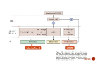 NSTEMIInfarctus Type 2
2016
 