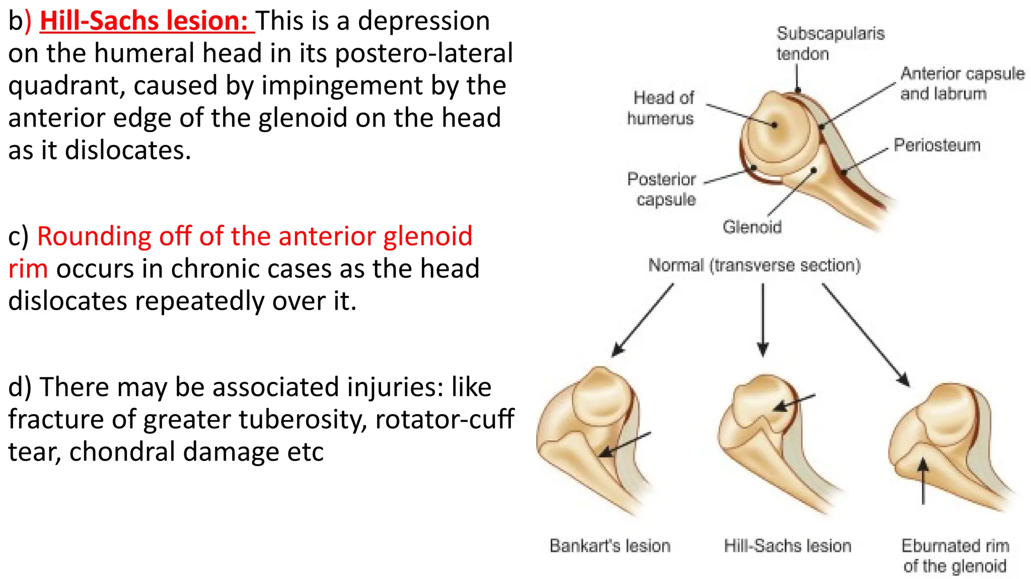 scapula fracture along with treatment .pptx
