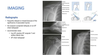 A review of Scapula Fractures with it's managment.pptx