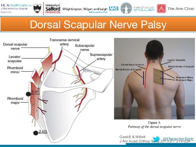 Scapula Pain