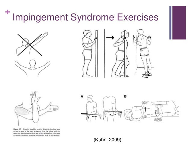 What are some symptoms of shoulder impingement syndrome?