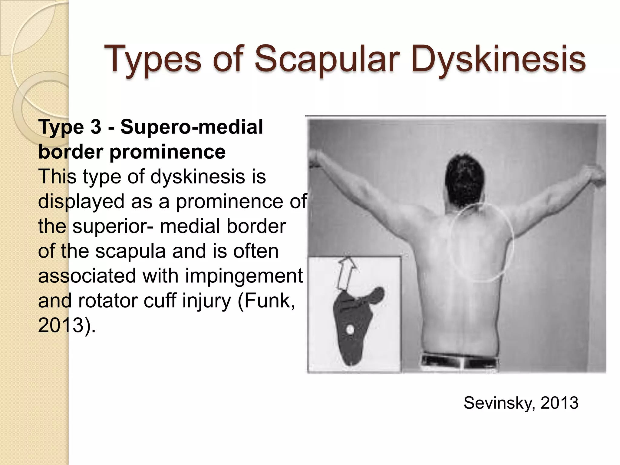 Types of Scapular Dyskinesis
Type 3 - Supero-medial
border prominence
This type of dyskinesis is
displayed as a prominence of
the superior- medial border
of the scapula and is often
associated with impingement
and rotator cuff injury (Funk,
2013).
Sevinsky, 2013
 