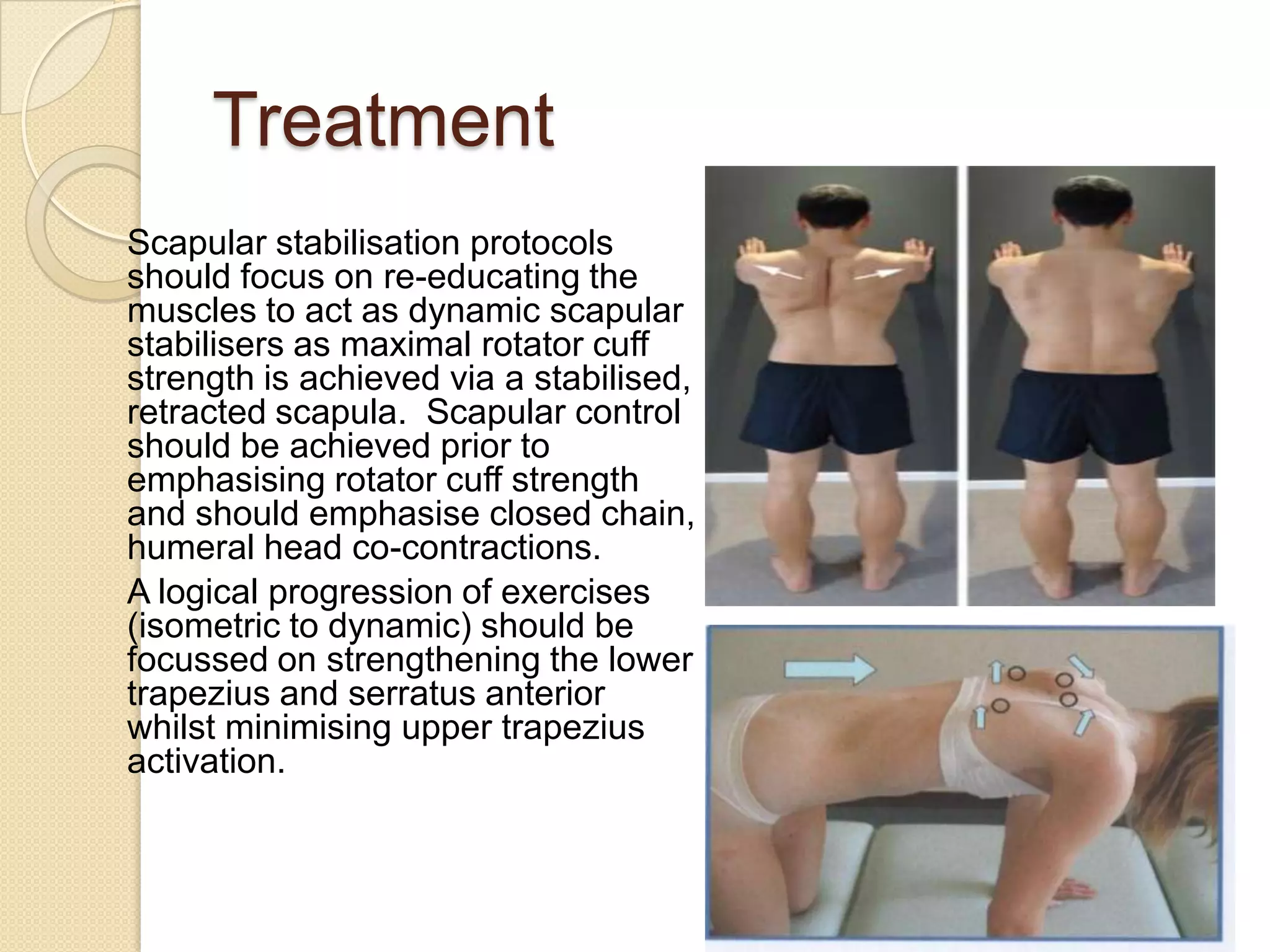 Treatment
Scapular stabilisation protocols
should focus on re-educating the
muscles to act as dynamic scapular
stabilisers as maximal rotator cuff
strength is achieved via a stabilised,
retracted scapula. Scapular control
should be achieved prior to
emphasising rotator cuff strength
and should emphasise closed chain,
humeral head co-contractions.
A logical progression of exercises
(isometric to dynamic) should be
focussed on strengthening the lower
trapezius and serratus anterior
whilst minimising upper trapezius
activation.
 