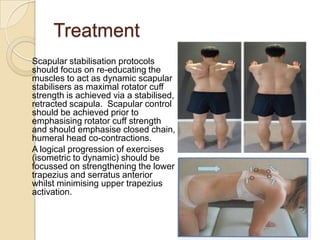 Treatment
Scapular stabilisation protocols
should focus on re-educating the
muscles to act as dynamic scapular
stabilisers as maximal rotator cuff
strength is achieved via a stabilised,
retracted scapula. Scapular control
should be achieved prior to
emphasising rotator cuff strength
and should emphasise closed chain,
humeral head co-contractions.
A logical progression of exercises
(isometric to dynamic) should be
focussed on strengthening the lower
trapezius and serratus anterior
whilst minimising upper trapezius
activation.
 