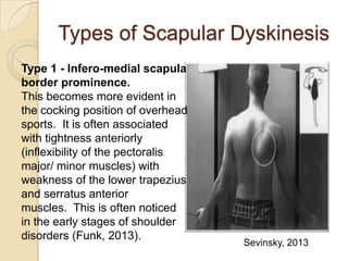Types of Scapular Dyskinesis
Type 1 - Infero-medial scapula
border prominence.
This becomes more evident in
the cocking position of overhead
sports. It is often associated
with tightness anteriorly
(inflexibility of the pectoralis
major/ minor muscles) with
weakness of the lower trapezius
and serratus anterior
muscles. This is often noticed
in the early stages of shoulder
disorders (Funk, 2013).
Sevinsky, 2013
 