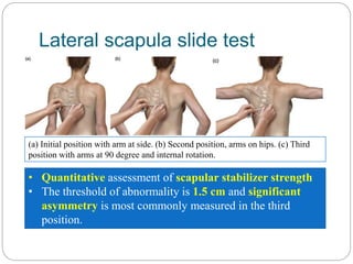 Scapular Dyskinesis Test | (PDF) Scapular dyskinesis: Diagnosis and ...