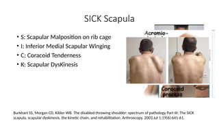 SICK Scapula
• S: Scapular Malposition on rib cage
• I: Inferior Medial Scapular Winging
• C: Coracoid Tenderness
• K: Scapular DysKinesis
Burkhart SS, Morgan CD, Kibler WB. The disabled throwing shoulder: spectrum of pathology Part III: The SICK
scapula, scapular dyskinesis, the kinetic chain, and rehabilitation. Arthroscopy. 2003 Jul 1;19(6):641-61.
 