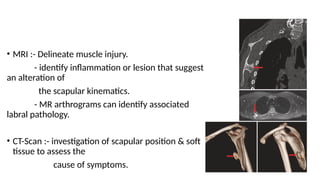 • MRI :- Delineate muscle injury.
- identify inflammation or lesion that suggest
an alteration of
the scapular kinematics.
- MR arthrograms can identify associated
labral pathology.
• CT-Scan :- investigation of scapular position & soft
tissue to assess the
cause of symptoms.
 