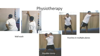 Physiotherapy
Wall wash
Punches in multiple planes
Shoulder dump
 