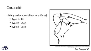 Scapular FracturesDJKLKLKLAJJFJJJJJJJJJJ | PPTX